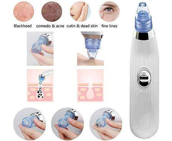 Derma-Suction Facial Pore Cleanser | Blackhead Remover, Acne Extractor & Deep Pore Vacuum Suction Tool